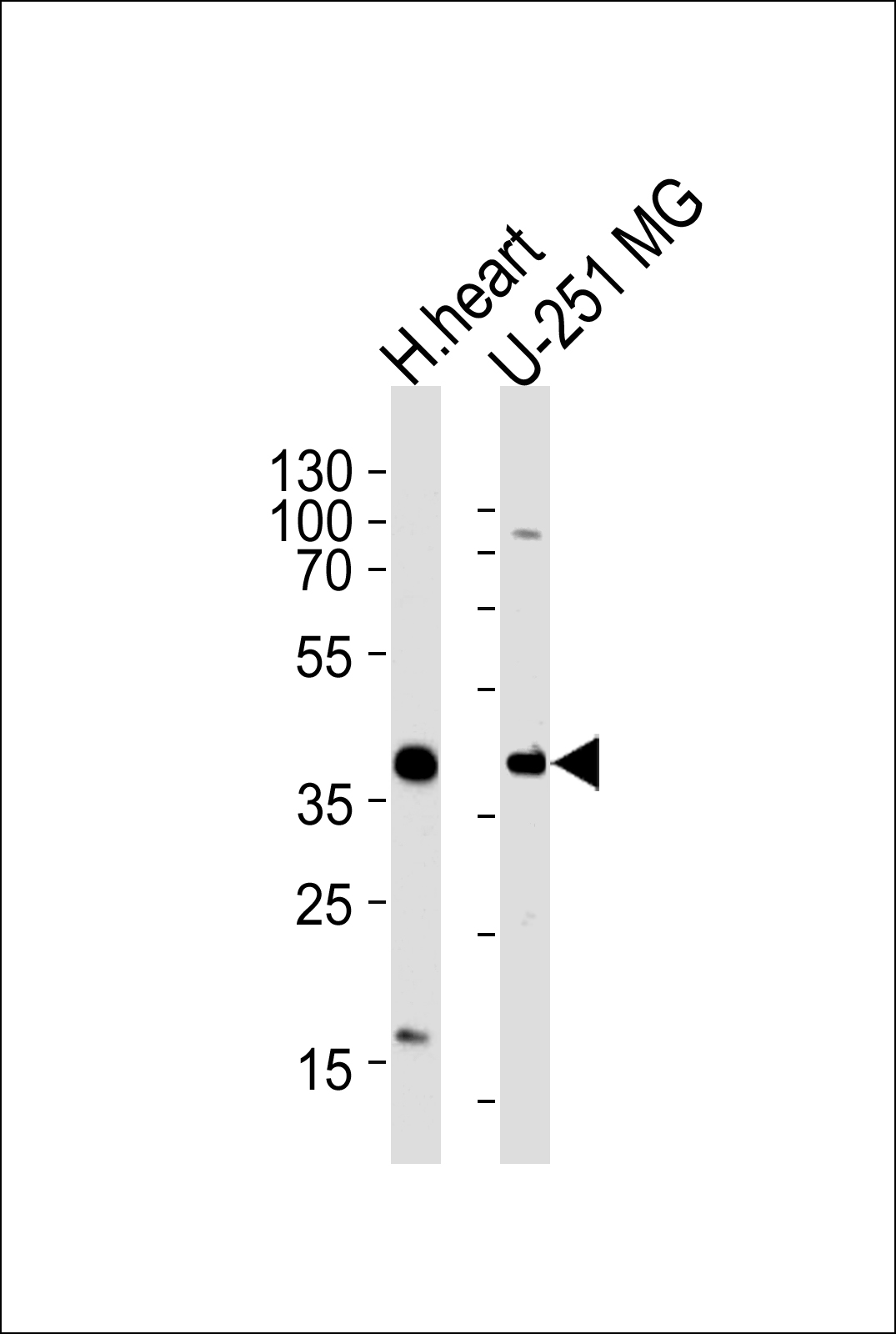AKTIP(C-term)