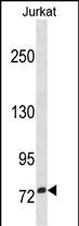 ZNF274(N-term)