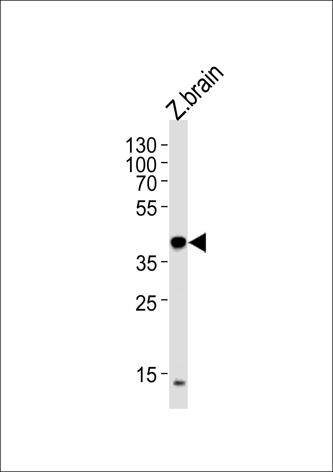 EIF3E(Center)