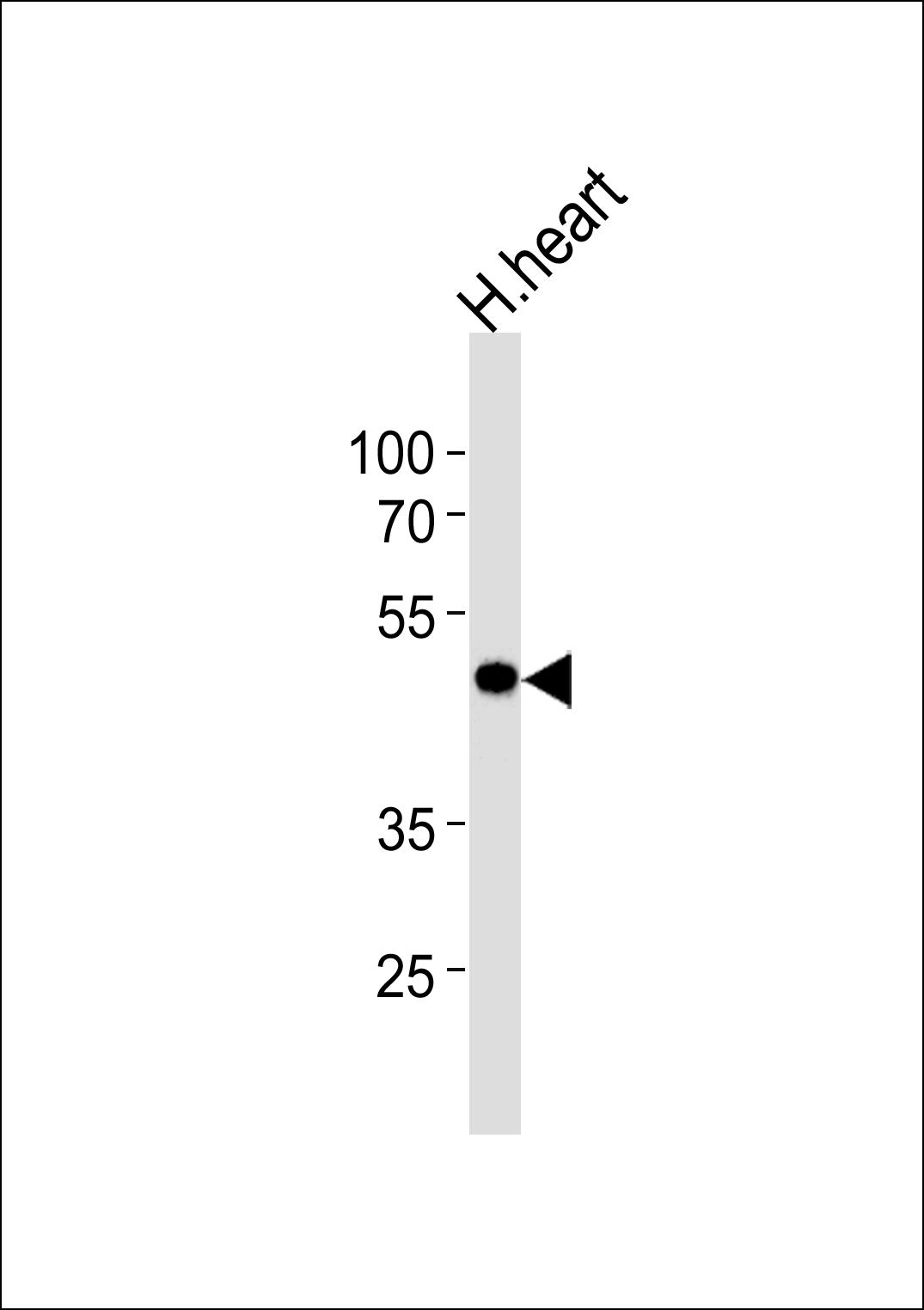 KCNAB1(N-term)
