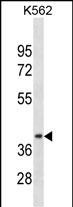 CCNDBP1(N-term)