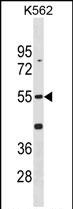 Mouse Cdk14(N-term)