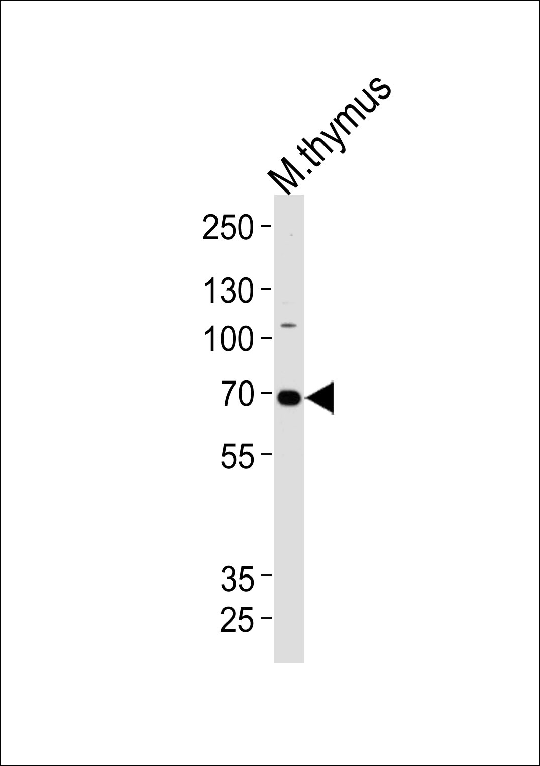 Mouse Ephb6(Center)