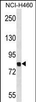 Mouse Dyrk1a(C-term)