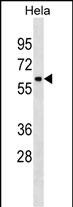 ZNF410(C-term)