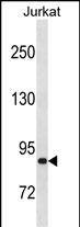 ZNF337(C-term)