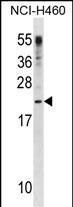 CSF3(C-term)