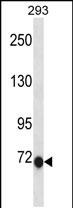 CLIC6(C-term)