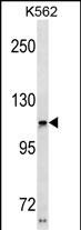 USH1C(N-term)