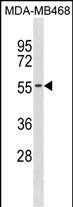 KCNK6(C-term)