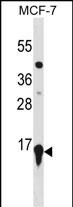 HIST2H3A(C-term)