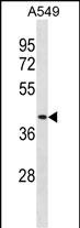 DPEP1(N-term)