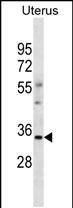 OR6S1(C-term)