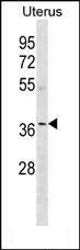 OR5W2(C-term)