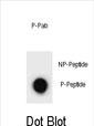 Phospho-ULK2(S323)