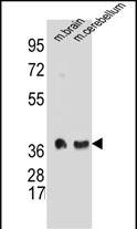 SYP(C-term)