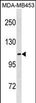 ENPP3(C-term)