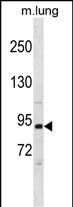 Mouse Pik3r1 (N-term)