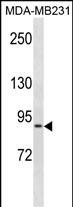 KIRREL(C-term)