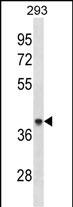 ACAA1