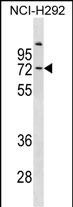 COL9A3