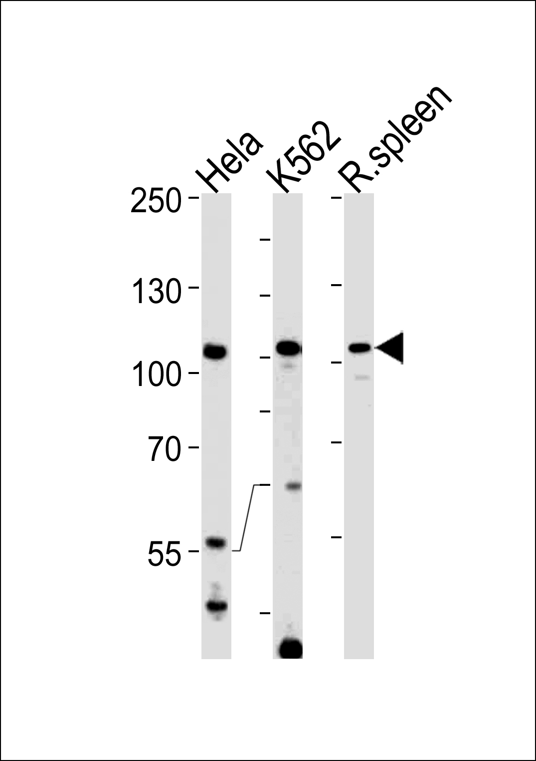 TFIP11 (N-term)