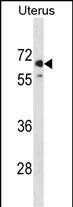 MMEL1 (N-term)