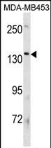 ATP8B3 (N-term)