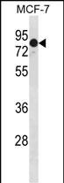 GATAD2A (N-term)