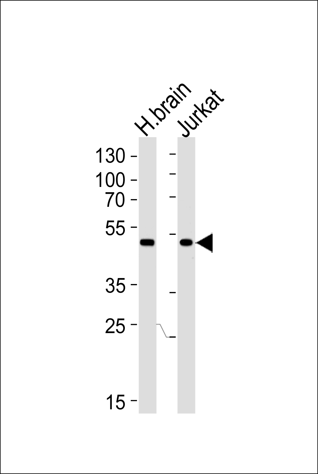 CHN1 (N-term)