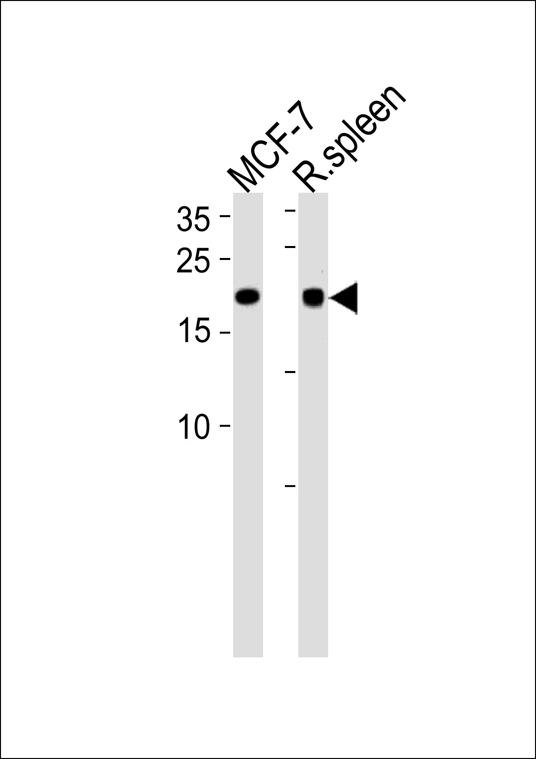 CNBP