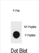 Phospho-mouse TSC2(S1412)