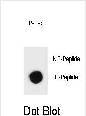 Phospho-rat TSC1(S312)