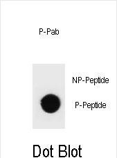 Phospho-rat TSC1(T417)