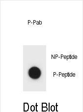 Phospho-IKKB(S177)