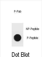 Phospho-mouse BAD(S96)