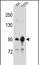 CTNNB1
