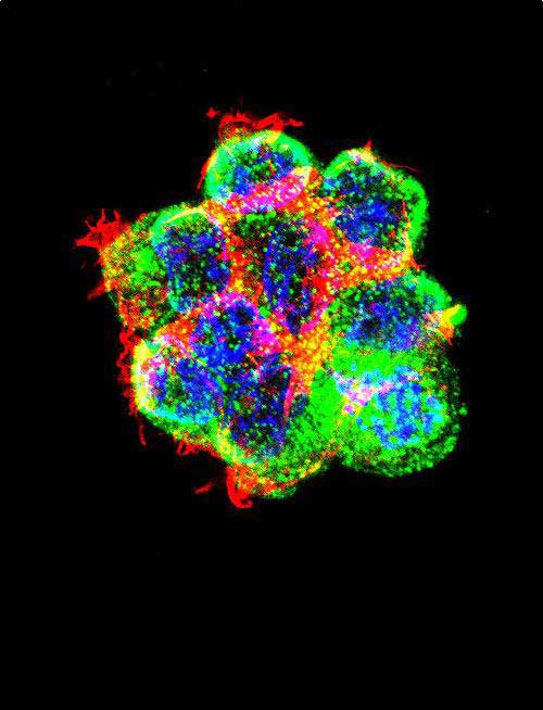 Rabbit Polyclonal Antibody to CTNNB1