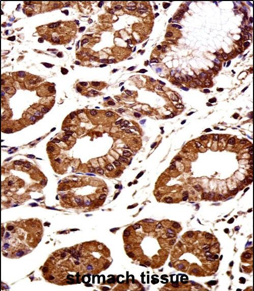 Rabbit Polyclonal Antibody to CTNNB1