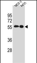 SRC (N-term)