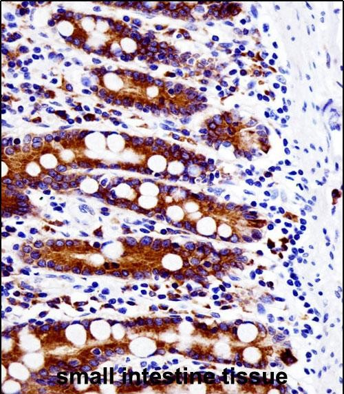 Rabbit Polyclonal Antibody to SRC (N-term)