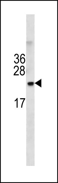 TMEM199 (N-term)