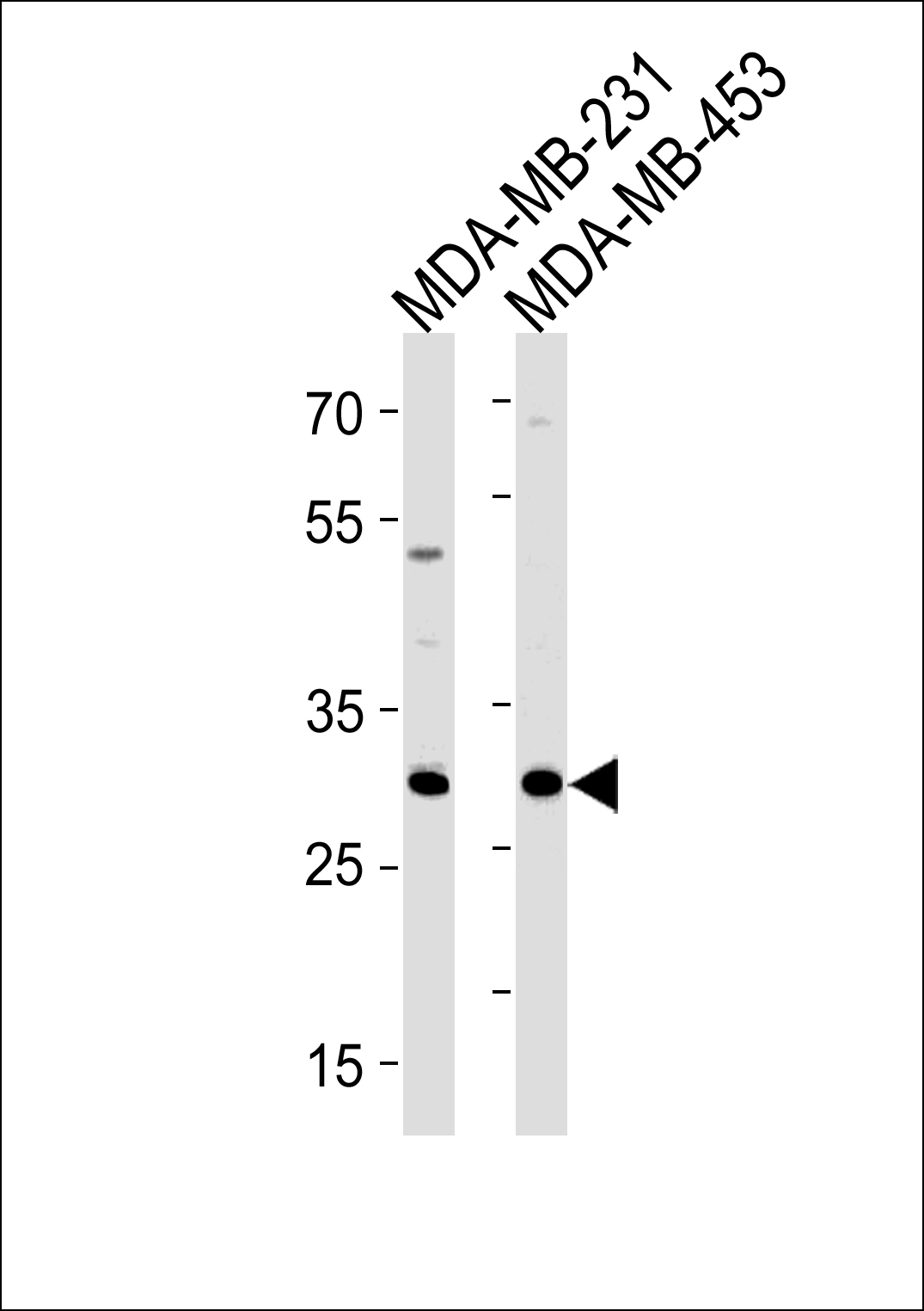 ASB11 (N-term)