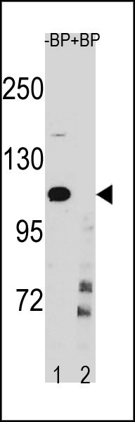 IKKB (Center Y609)