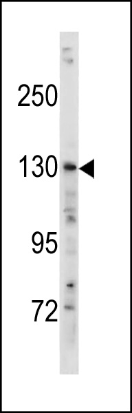 TSC1 (Center T417)