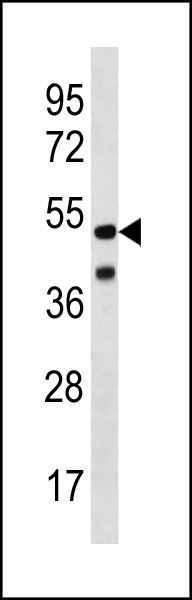 HHV14 UL38