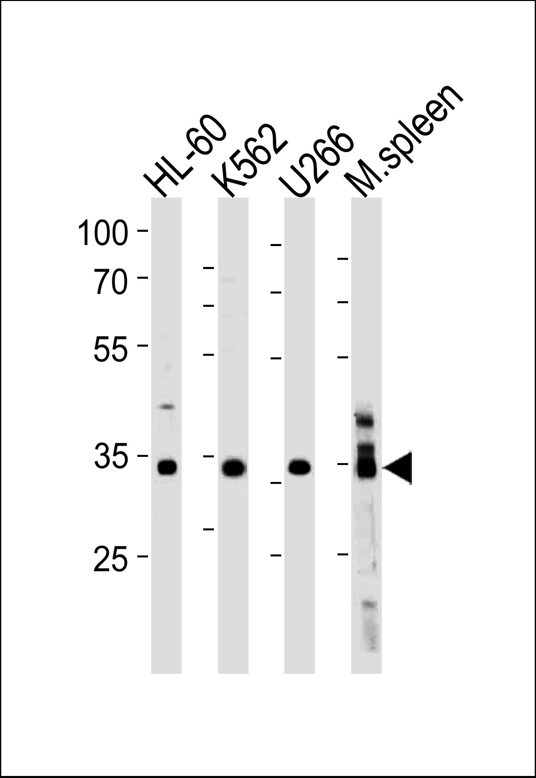 GFI1B