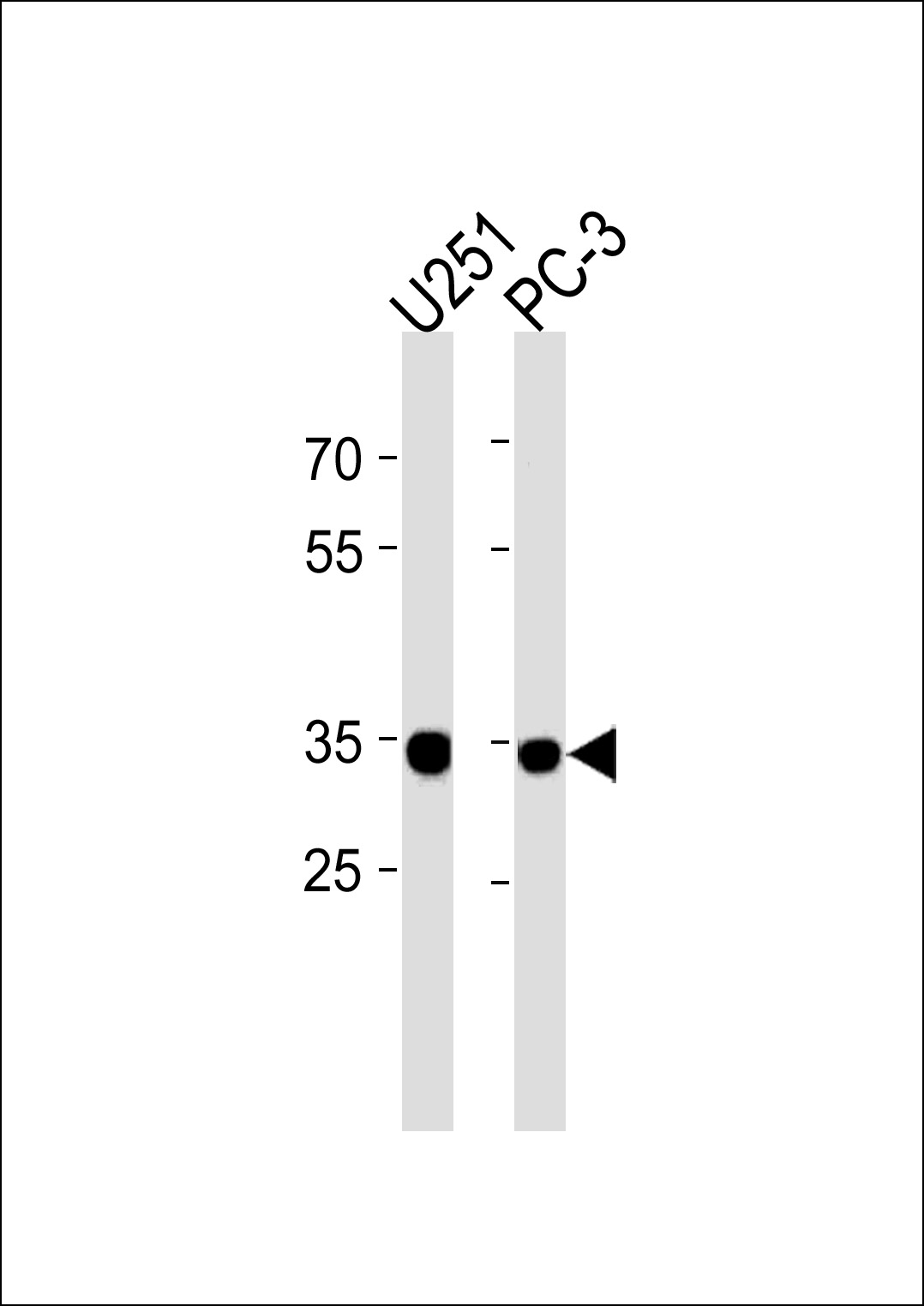 RPLP0P6 (N-term)