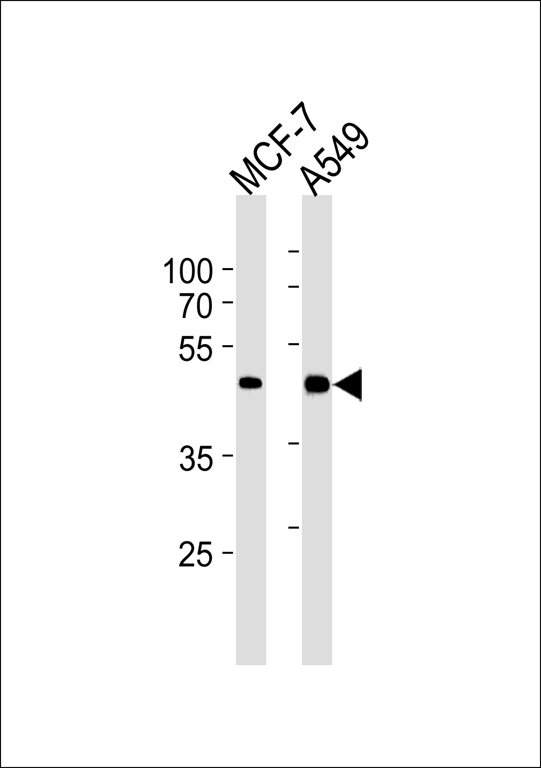 CCRK (N-term)