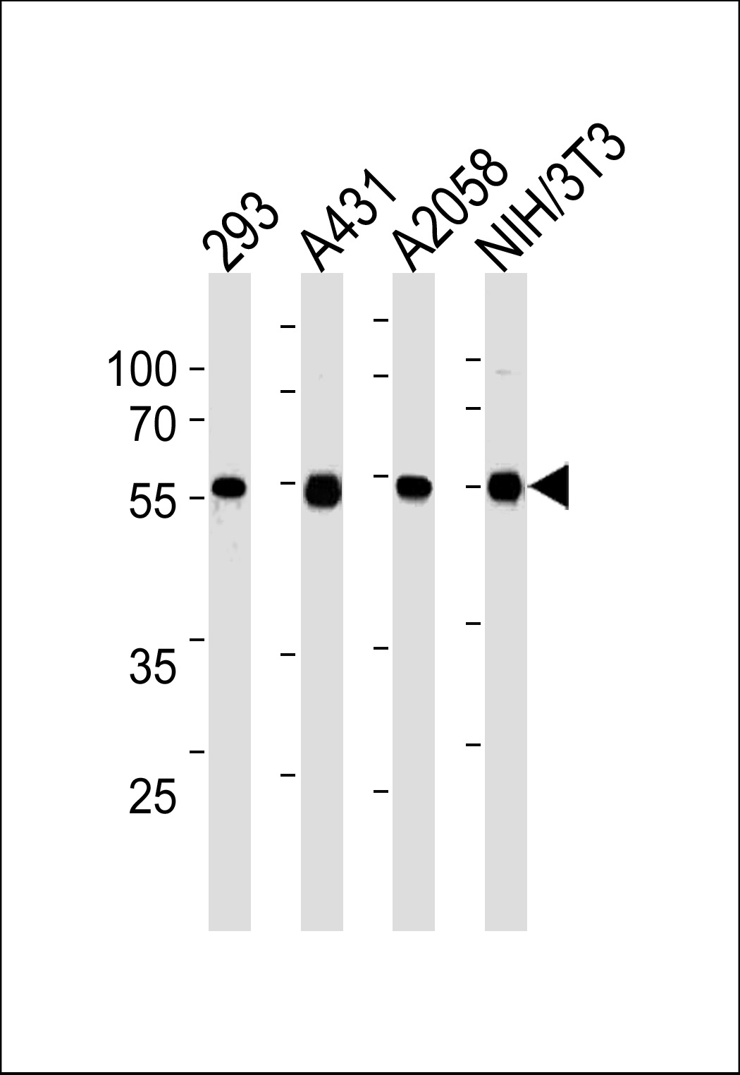 TPIPb(Ascites)